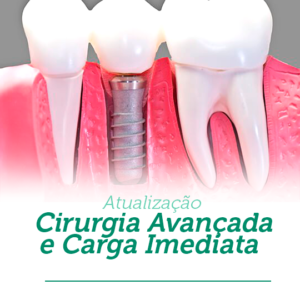 Cirurgia Avançada e Carga Imediata