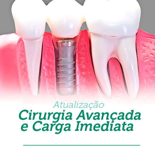 Leia mais sobre o artigo Cirurgia Avançada e Carga Imediata