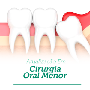 Cirurgia Oral Menor