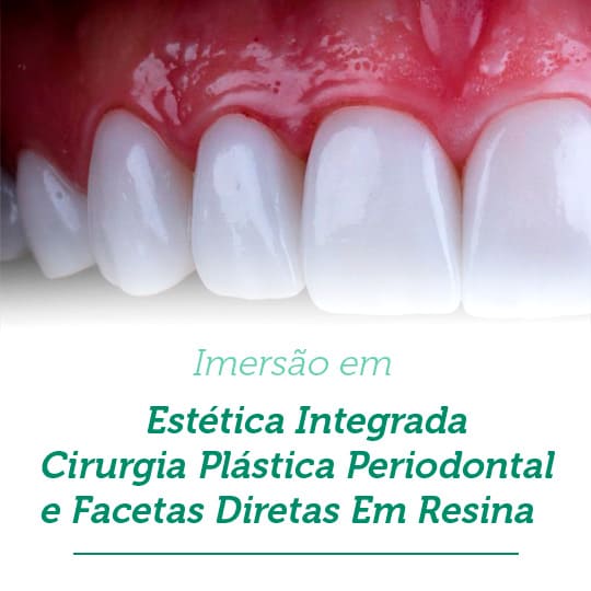 Leia mais sobre o artigo Estética Integrada Cirur. Plástica Perio. e Facetas Diretas em Resina